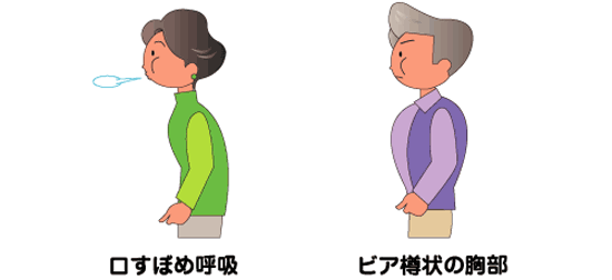 口すぼめ呼吸