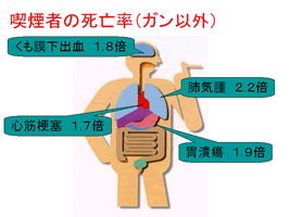 COPDの概念